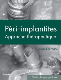 LES PÉRI-IMPLANTITES - UNE APPROCHE THÉRAPEUTIQUE