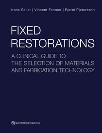 Fixed Restorations - A Clinical Guide to the Selection of Materials and Fabrication Technology