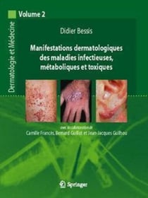 Manifestations dermatologiques des maladies infectieuses, métaboliques et toxiques...