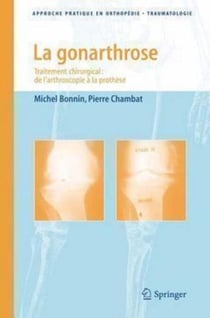 La gonarthrose - Traitement chirurgical : de l'arthroscopie à la prothèse