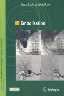 Embolisation - (Coll. de la Société française d'imagerie cardiaque et vasculaire)