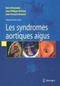 Syndromes aortiques aigus - Aspects modernes de la physiopathologie, du diagnostic et du traitement