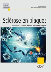 Sclérose en plaques