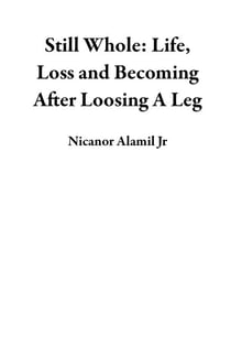 Still Whole: Life, Loss and Becoming After Losing A Leg