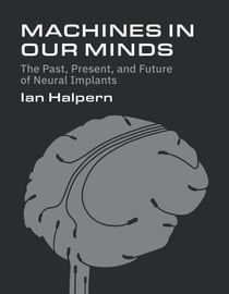 Machines in Our Minds - The Past, Present, and Future of Neural Implants