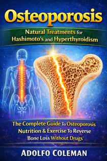 Osteoporosis: Natural Treatments for Hashimoto's and Hyperthyroidism - The Complete Guide To Osteoporosis Nutrition & Exercise To Reverse Bone Loss Without Drugs