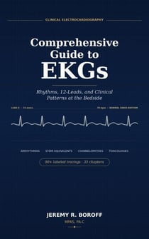 Comprehensive Guide to EKG's  Rhythms, 12 leads, and Clinical Patterns at Bedside