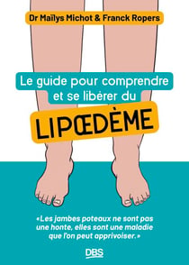 Le guide pour comprendre et se libérer du lipoedème - Les jambes poteaux ne sont pas une honte, elles sont une maladie que l'on peut apprivoiser