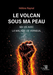 Le volcan sous ma peau - Ma vie avec la maladie de Verneuil