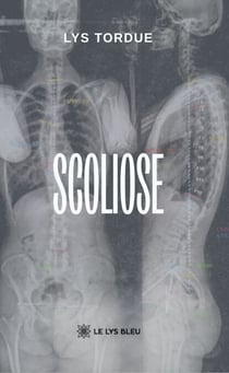 Scoliose