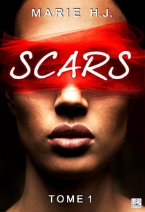 Scars