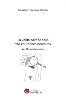 La vérité cachée sous vos couronnes dentaires - Les Dents dévitalisées