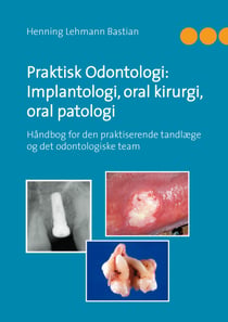 Praktisk Odontologi: Implantologi, oral kirurgi, oral patologi - Håndbog for den praktiserende tandlæge og det odontologiske team