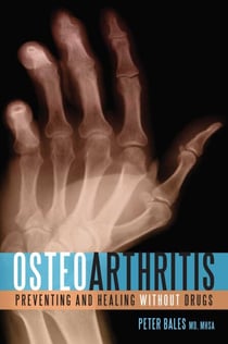 Osteoarthritis - Preventing and Healing Without Drugs