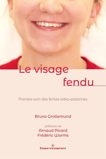 Le visage fendu : Prendre soin des fentes labio-palatines