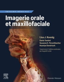 Imagerie orale et maxillofaciale