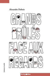 Grands brûlés face aux regards : Épreuves et luttes pour la reconnaissance