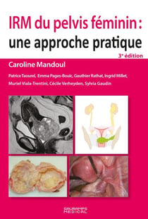 IRM du pelvis féminin : Une approche pratique (3e édition)