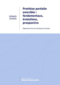 Prothèse partielle amovible : fondamentaux, évolutions, prospective : Répertoire de cas cliniques et tracés
