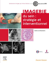 Imagerie du sein : stratégie et interventionnel