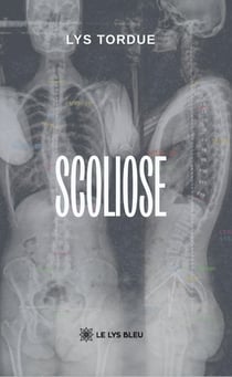 Scoliose