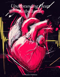 Understanding Heart Arrhythmias - Understanding Medicine