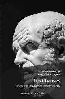 Les chauves - Histoire d'un préjugé dans la Rome antique