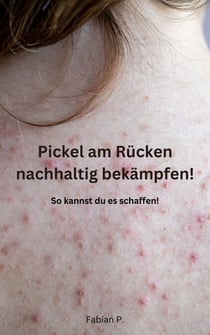 Pickel am Rücken nachhaltig bekämpfen! - So kannst du es schaffen!