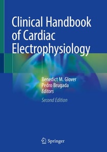 Clinical Handbook of Cardiac Electrophysiology