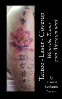 Tattoo - Laser - Cover Up - Wenn der Traum zum Albtraum wird