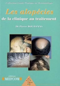 Les alopecies clinique au traitement