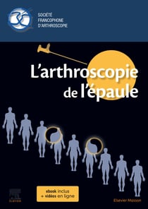 L'arthroscopie de l'épaule (2e édition)
