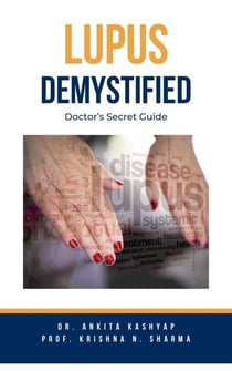Lupus Demystified: Doctor’s Secret Guide