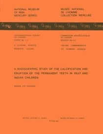 Radiographic Study of the Calcification and Eruption of the Permanent Teeth in Inuit and Indian Children