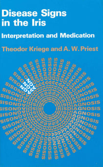 Disease Signs In The Iris - Interpretation and Medication