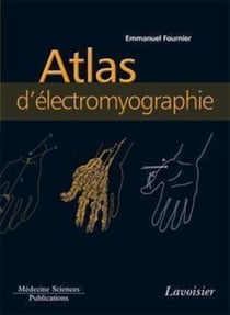 Atlas d'électromyographie