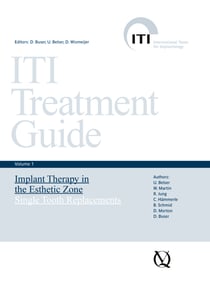Implant Therapy in the Esthetic Zone - Single-Tooth Replacements