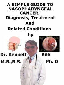 A  Simple  Guide  to  Nasopharyngeal Cancer,  Diagnosis, Treatment,   and   Related Conditions