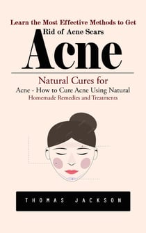 Acne: Learn the Most Effective Methods to Get Rid of Acne Scars (Natural Cures for Acne - How to Cure Acne Using Natural Homemade Remedies and Treatments)