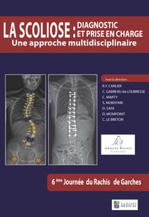 La scoliose : diagnostic et prise en charge