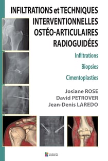 Infiltrations et techniques interventionnelles ostéo-articulaires radioguidées