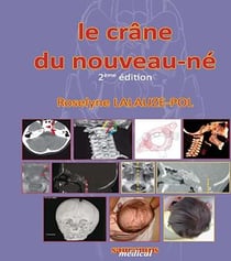 Le crâne du nouveau-né - 2e édition