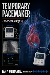 Temporary Cardiac Pacing: Practical Insights - Medical Series