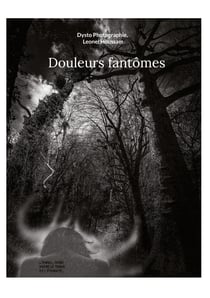 Douleurs fantômes