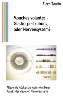 Mouches volantes - Glaskörpertrübung oder Nervensystem? - Fliegende Mücken als wahrnehmbarer Aspekt des visuellen Nervensystems