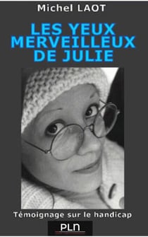 Les yeux merveilleux de Julie - Témoignage sur le handicap