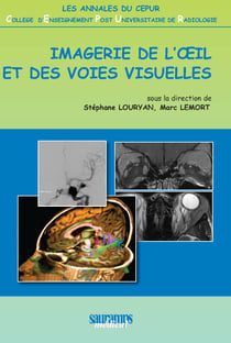 Imagerie de l'œil et des voies visuelles