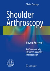 Shoulder Arthroscopy - How to Succeed!