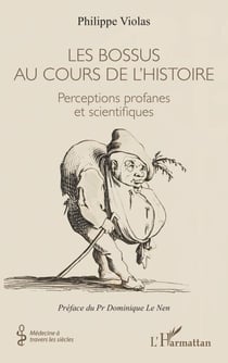 Les bossus au cours de l'histoire - Perceptions profanes et scientifiques