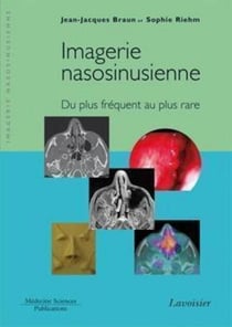 Imagerie nasosinusienne - Du plus fréquent au plus rare